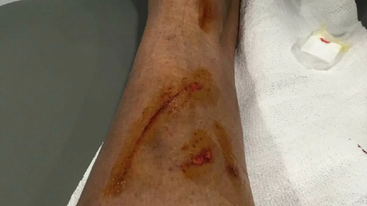 post card blog-buen-botiquin-herida.webp